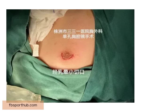 坎宁安气胸康复持续推进 活塞计划一周后复查评估
